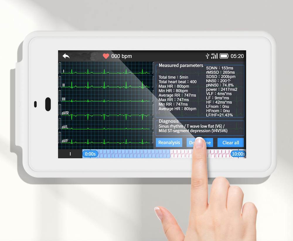 Mobile 6/12Lead EKG/ECG Machine Fits into Your Pocket, with Auto